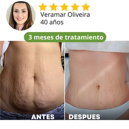 COMPRE 1 LLEVA 2 Skin Repair™ Nueva Formula Crema Reafirmante y Reductora - Vuelve a Tener una Piel Hermosa