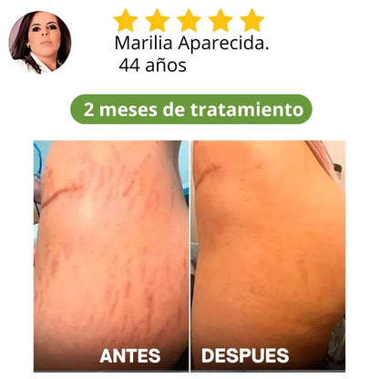 COMPRE 1 LLEVA 2 Skin Repair™ Nueva Formula Crema Reafirmante y Reductora - Vuelve a Tener una Piel Hermosa
