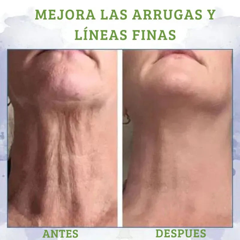 COMPRE 1 LLEVA 2 Skin Repair™ Nueva Formula Crema Reafirmante y Reductora - Vuelve a Tener una Piel Hermosa