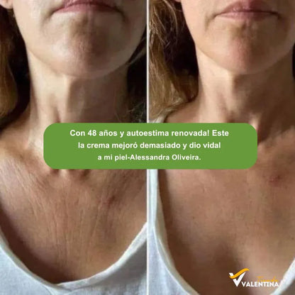 COMPRE 1 LLEVA 2 Skin Repair™ Nueva Formula Crema Reafirmante y Reductora - Vuelve a Tener una Piel Hermosa