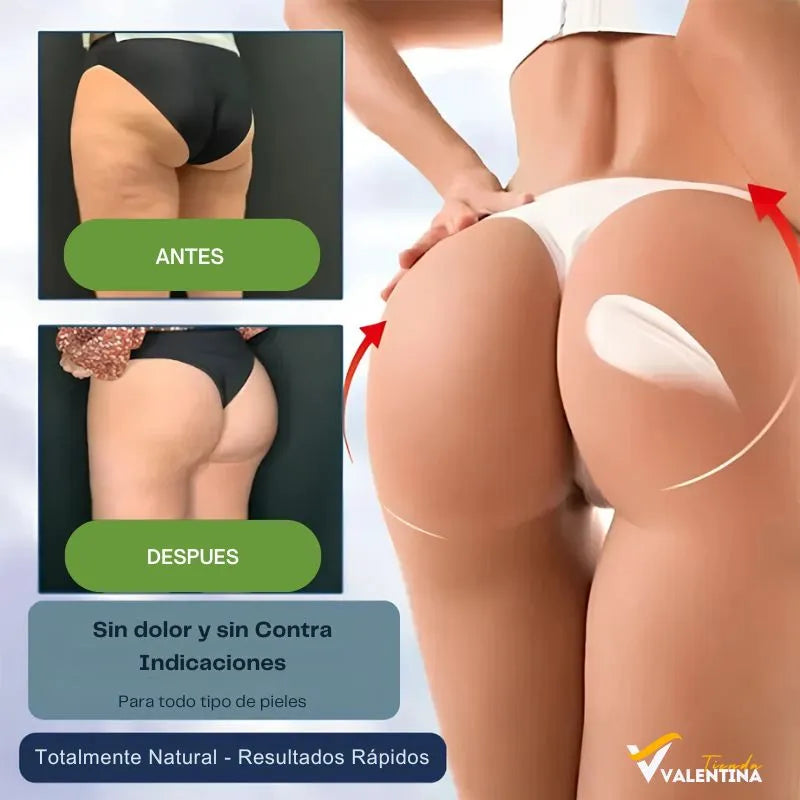COMPRE 1 LLEVA 2 Skin Repair™ Nueva Formula Crema Reafirmante y Reductora - Vuelve a Tener una Piel Hermosa